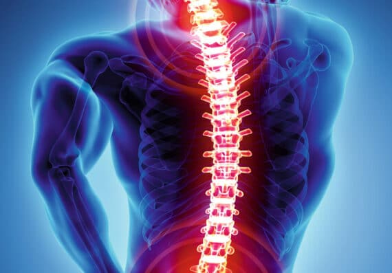 Wirbelsäule Rückenschmerzen
